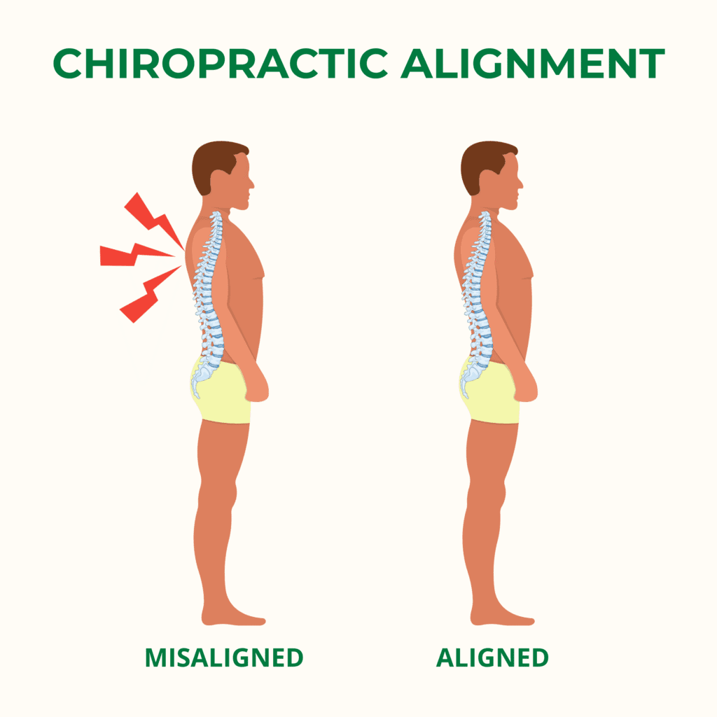 An illustration comparing two male figures side by side. The left figure shows a misaligned spine highlighted with red pain indicators, while the right figure shows a properly aligned spine, emphasizing the benefits of chiropractic care for posture and spinal health.